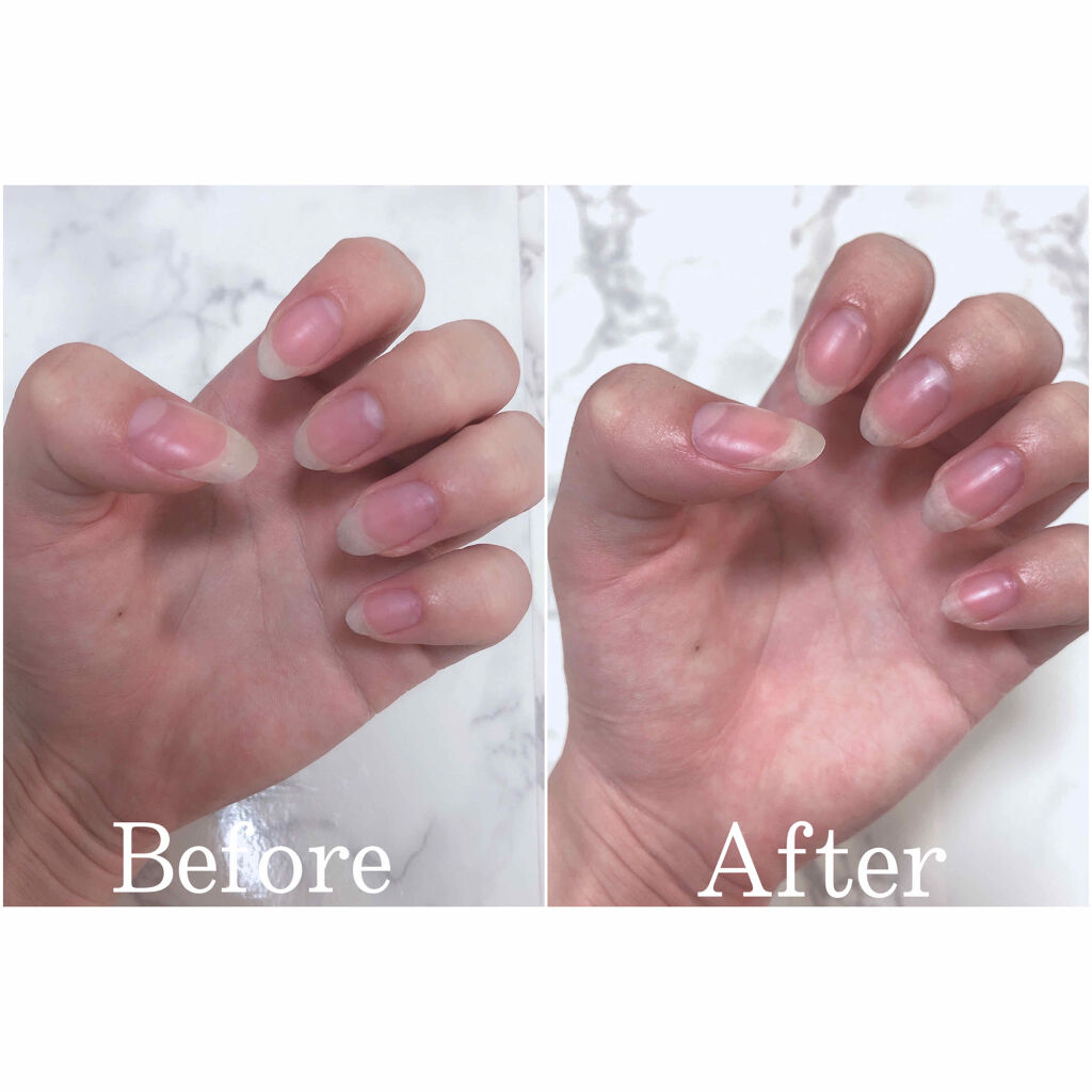 ゆびさき＆ネイルケアパック/DAISO/ネイル用品を使ったクチコミ（2枚目）