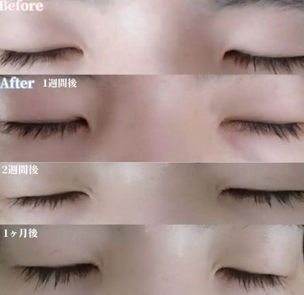 EMAKED(エマーキット)/水橋保寿堂製薬/まつげ美容液を使ったクチコミ(2枚目)
