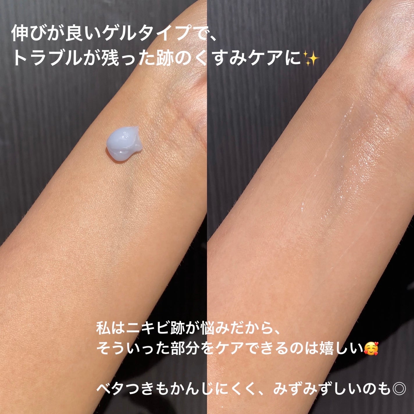 オニオンニューペア クリアパッド/Isntree/トナーパッドを使ったクチコミ(7枚目)