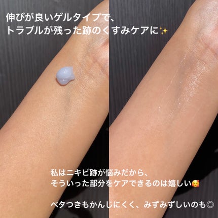 オニオンニューペア クリアパッド/Isntree/トナーパッドを使ったクチコミ(7枚目)