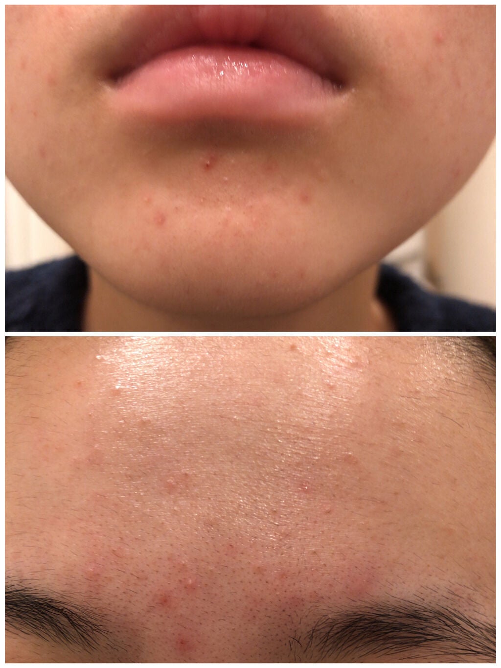 DHC はとむぎエキス/DHC/健康サプリメントを使ったクチコミ(7枚目)