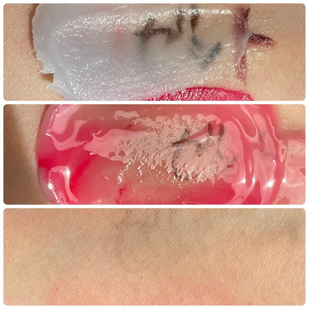 夢みるバーム アクネクリアモイスチャー/ロゼット/クレンジングバームを使ったクチコミ(5枚目)