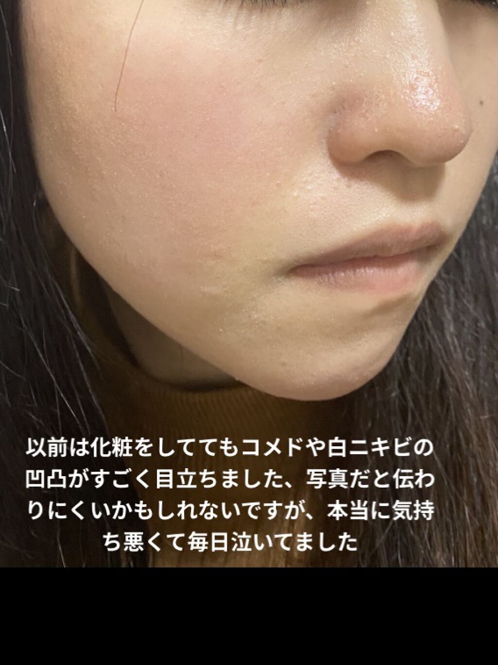 ミルキィ クレンズアップ/ACSEINE/ミルククレンジングを使ったクチコミ（2枚目）