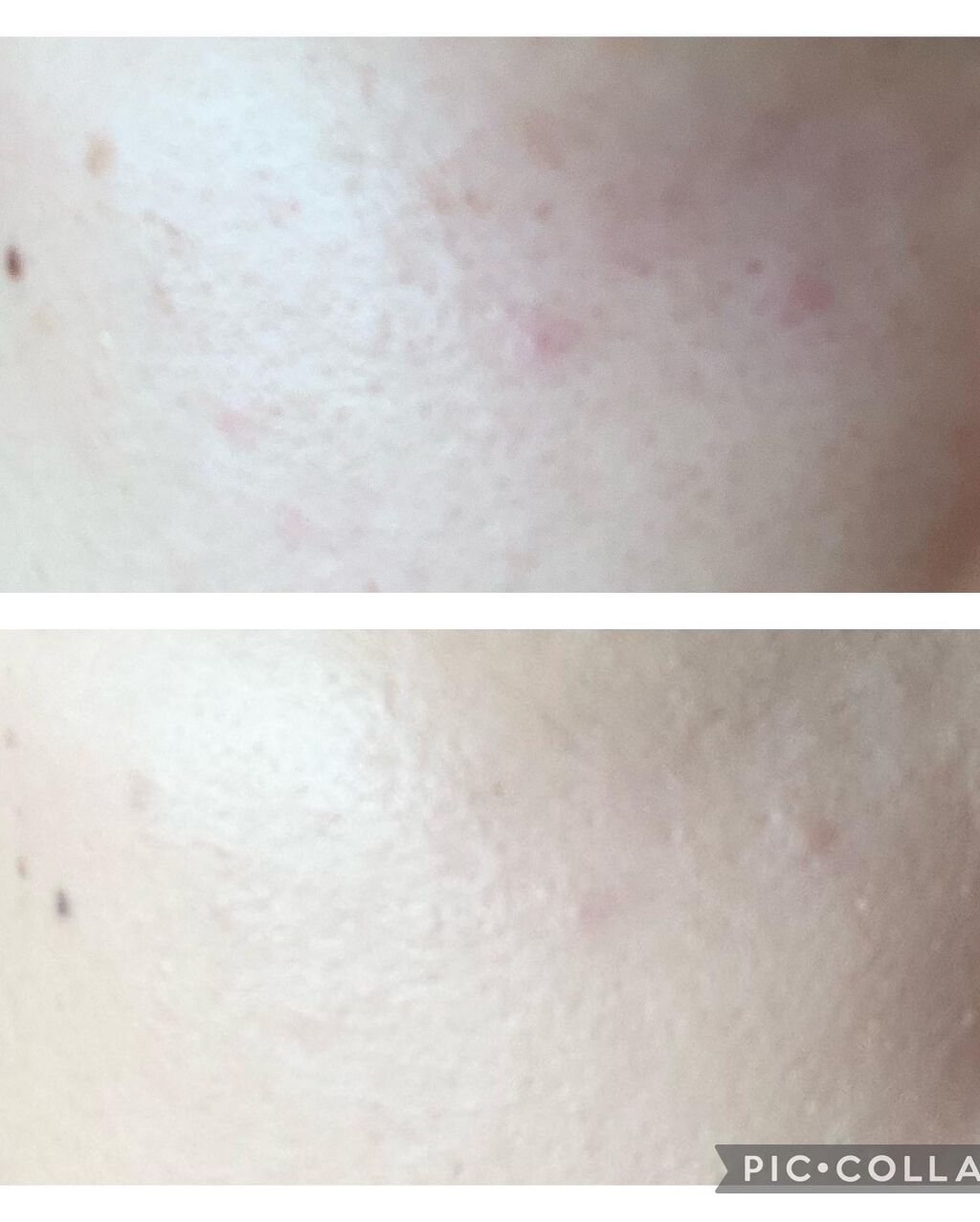 ピンクティーツリーカバークッション/APLIN/クッションファンデーションを使ったクチコミ（2枚目）