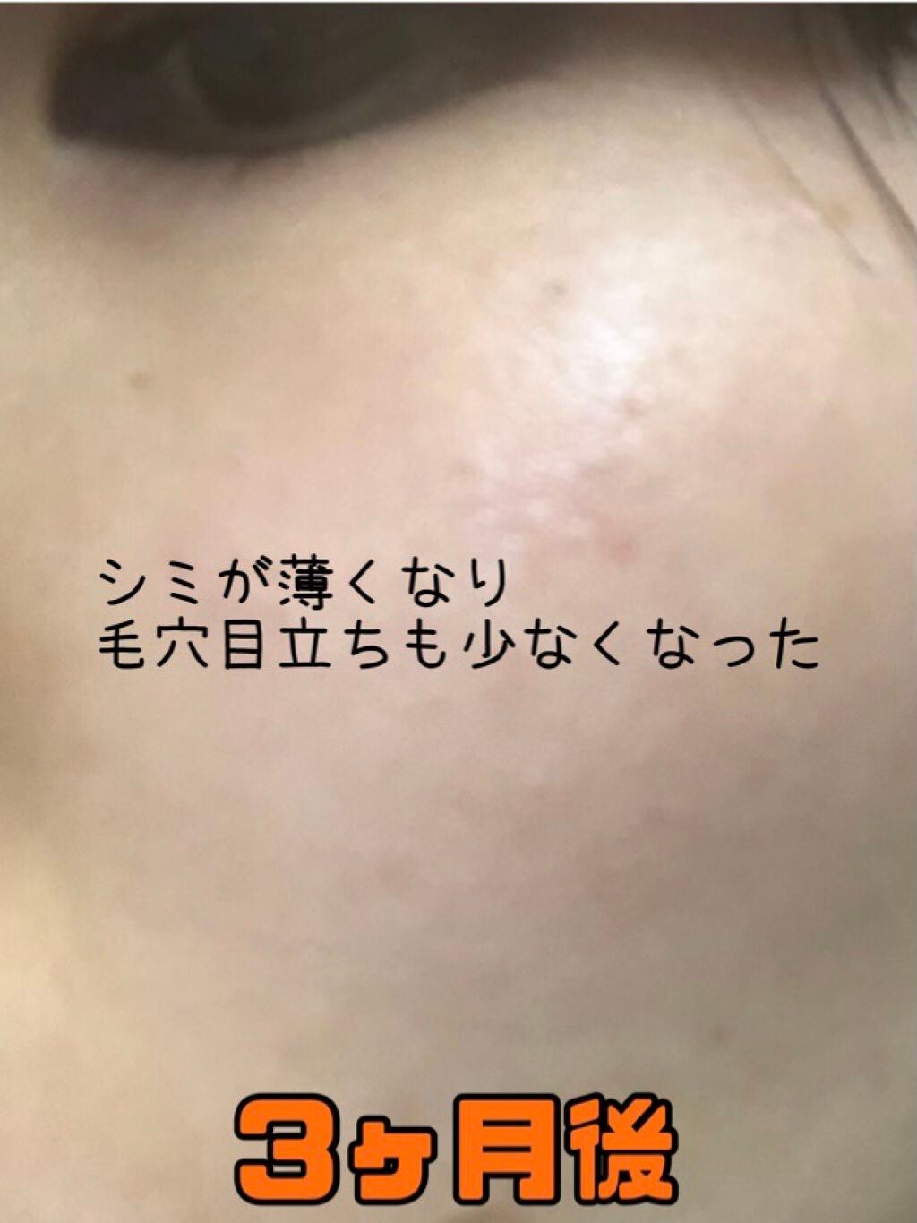 ミラミン/ZO Skin Health/フェイスクリームを使ったクチコミ(8枚目)