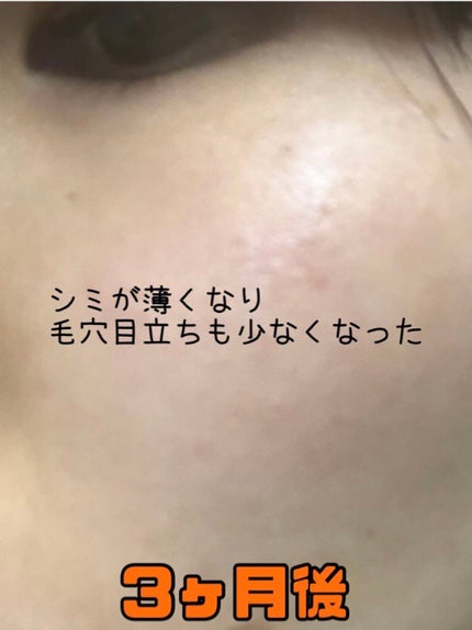 ミラミン/ZO Skin Health/フェイスクリームを使ったクチコミ(8枚目)