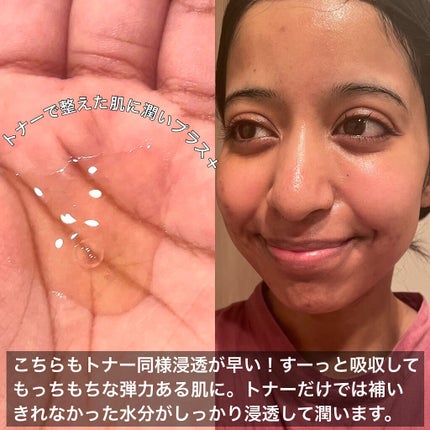 ドクダミ 77 スージングトナー/Anua/化粧水を使ったクチコミ(8枚目)