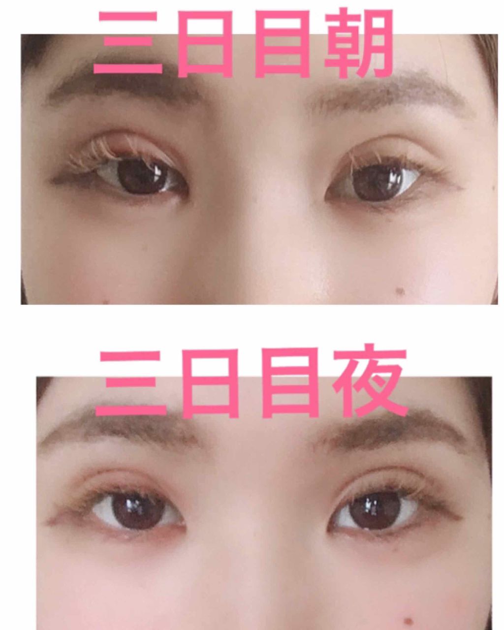 ðçå§«ðŸ on LIPS ãã ãã¶èªç¶ã«ãªã£ãŠããæ°ãããŸãå
åºè¡ã®èµ€ã¿ãã ãã¶ã²ããŸãã..ãïŒ4æç®ïŒ