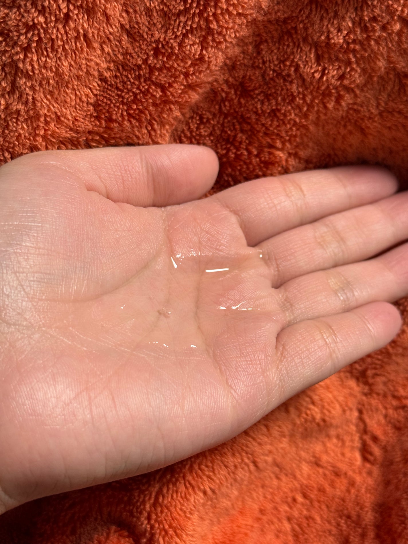 VC100エッセンスローション EX/ドクターシーラボⓇ/化粧水を使ったクチコミ(3枚目)