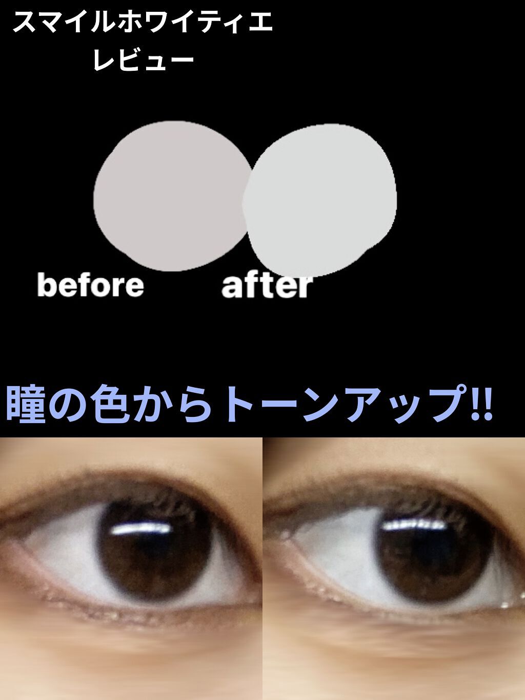 スマイルホワイティエ(医薬品)/ライオン/その他を使ったクチコミ（1枚目）