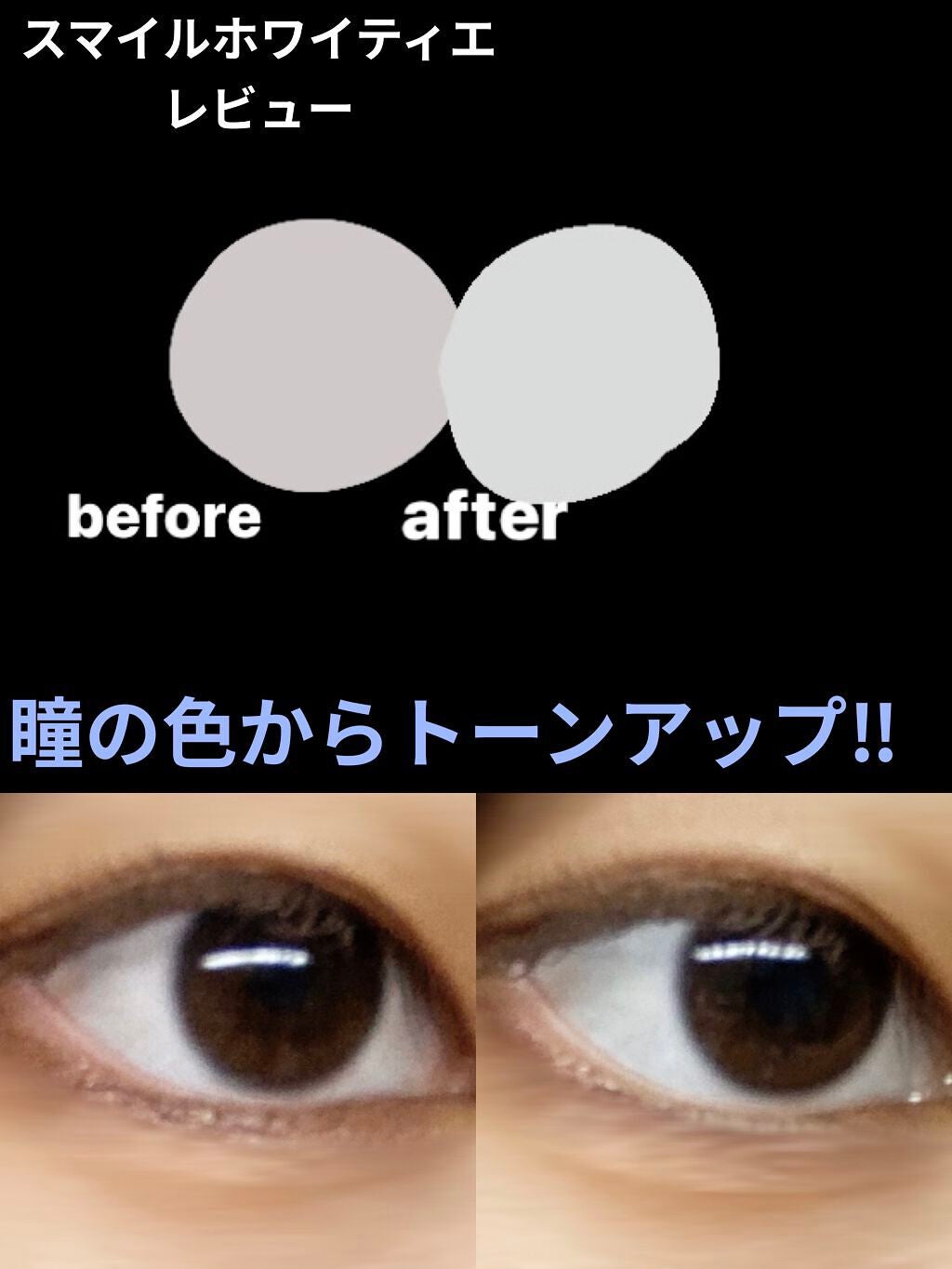 スマイルホワイティエ(医薬品)/ライオン/その他を使ったクチコミ(1枚目)