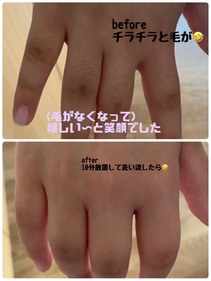 除毛クリーム ジャスミンハニー/スリンキータッチ セルフスパ/除毛クリームを使ったクチコミ(2枚目)