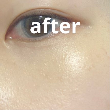 【旧】ディオールスキン フォーエヴァー スキン コレクト コンシーラー/Dior/リキッドコンシーラーを使ったクチコミ(4枚目)