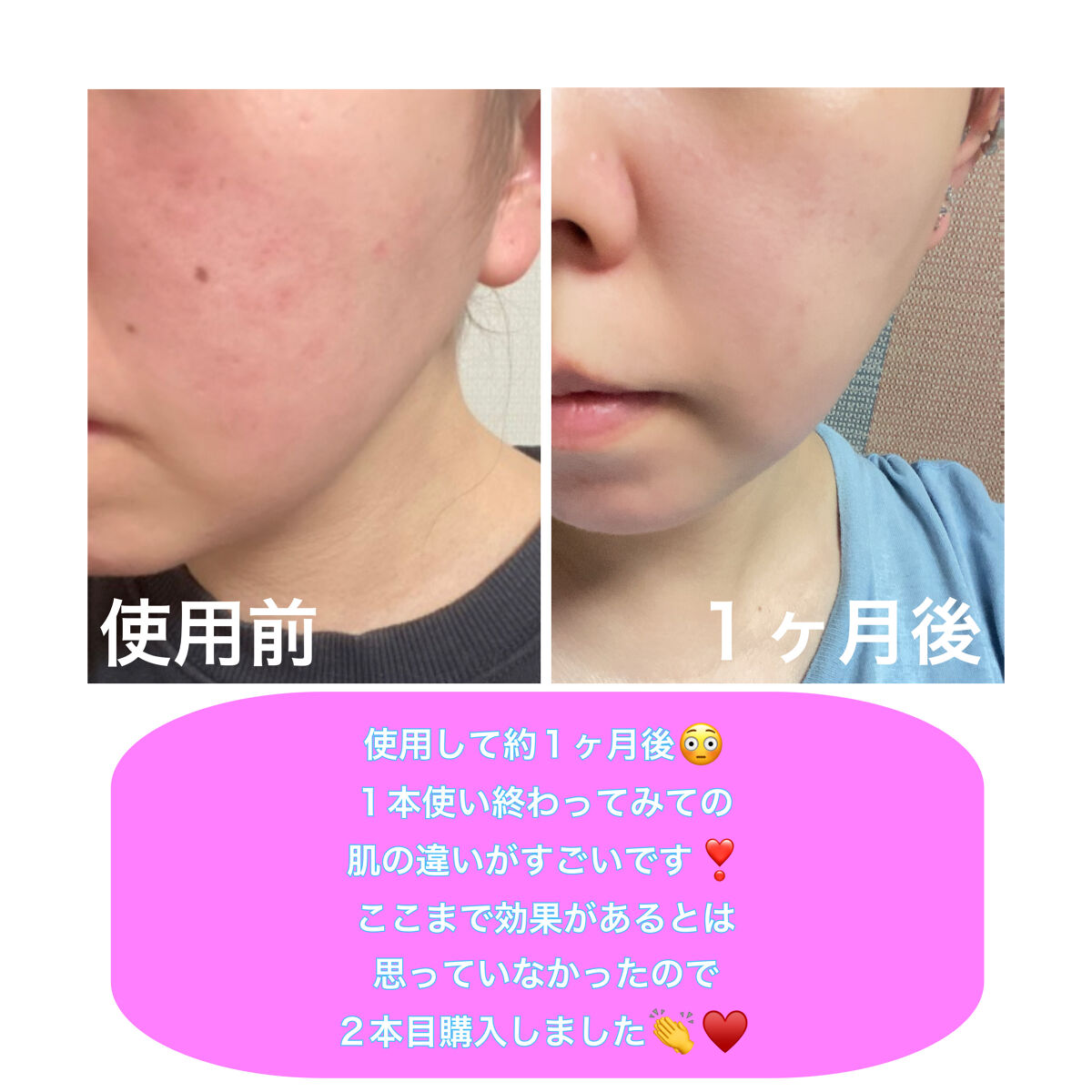 ザビタミンC23/IOPE/美容液を使ったクチコミ（2枚目）