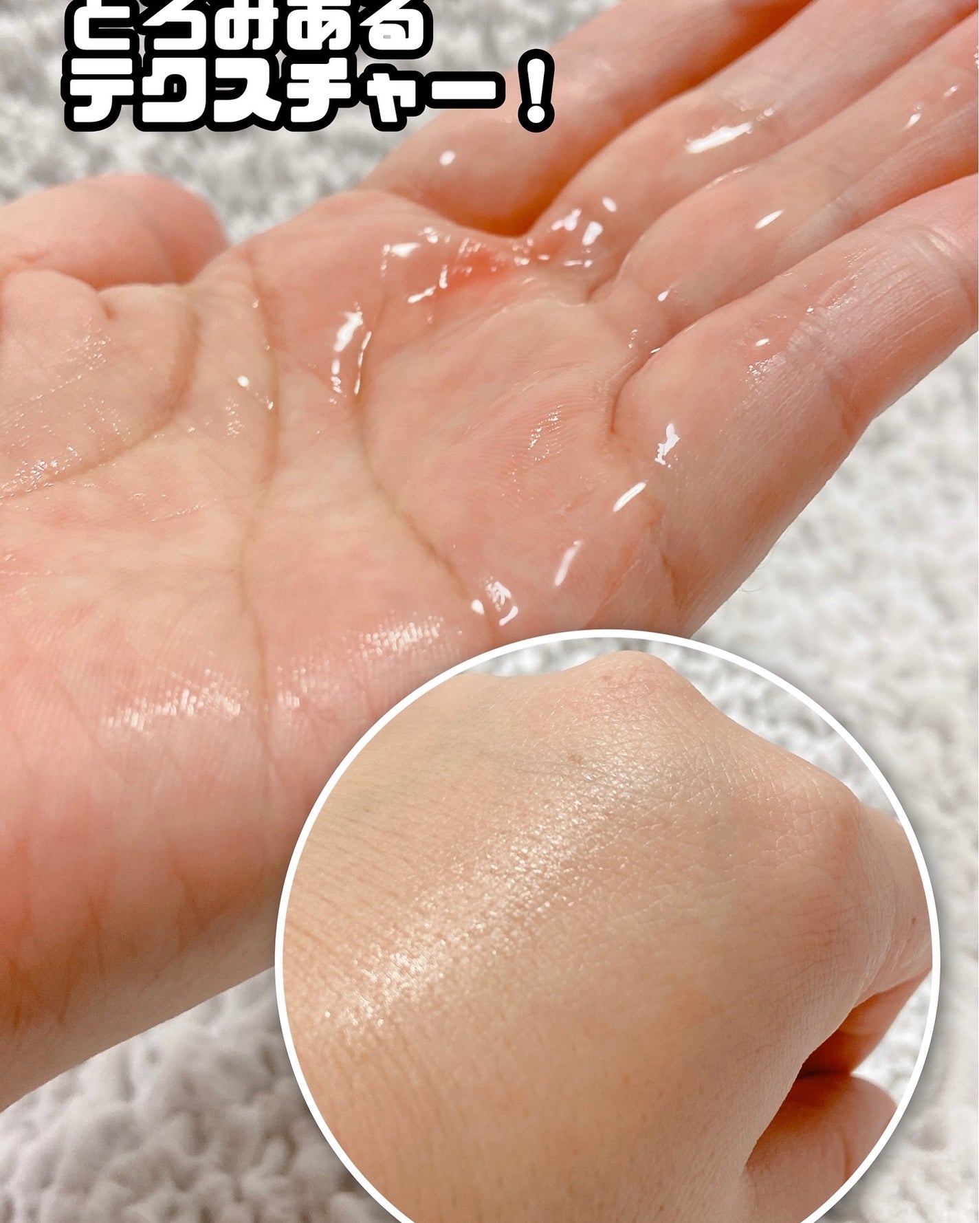 VC100エッセンスローション EX/ドクターシーラボⓇ/化粧水を使ったクチコミ(2枚目)