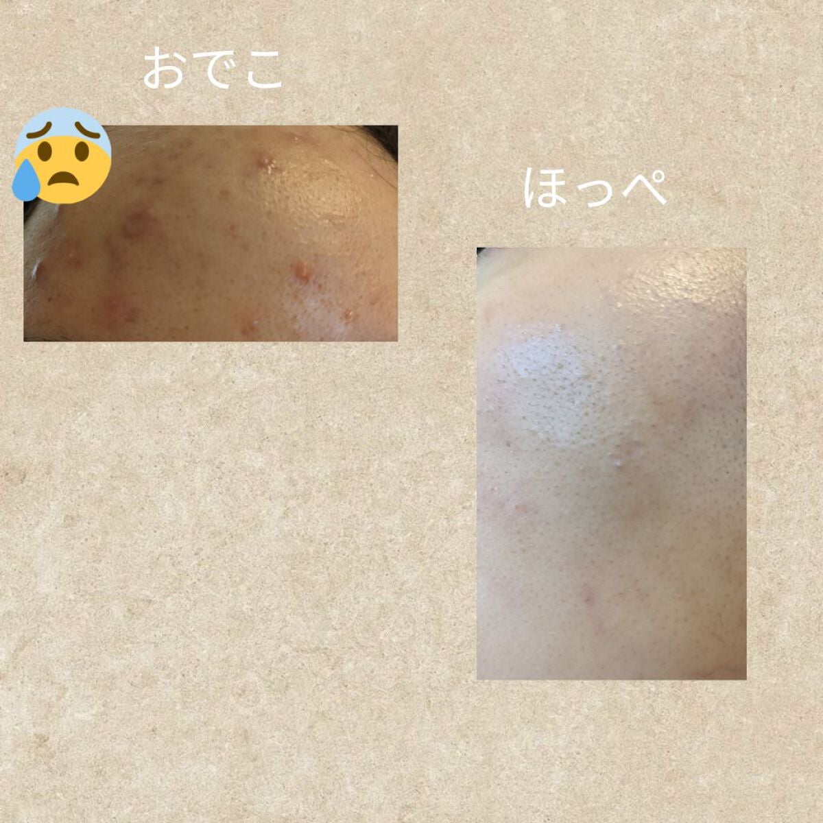 あずき on LIPS 「肌再生計画*2日目特筆することはないです。いつもどおりスキンケ..」(2枚目)