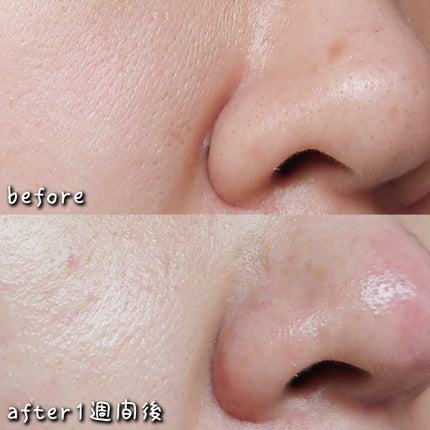 泥ジェル洗顔/ファンケル/その他洗顔料を使ったクチコミ(4枚目)