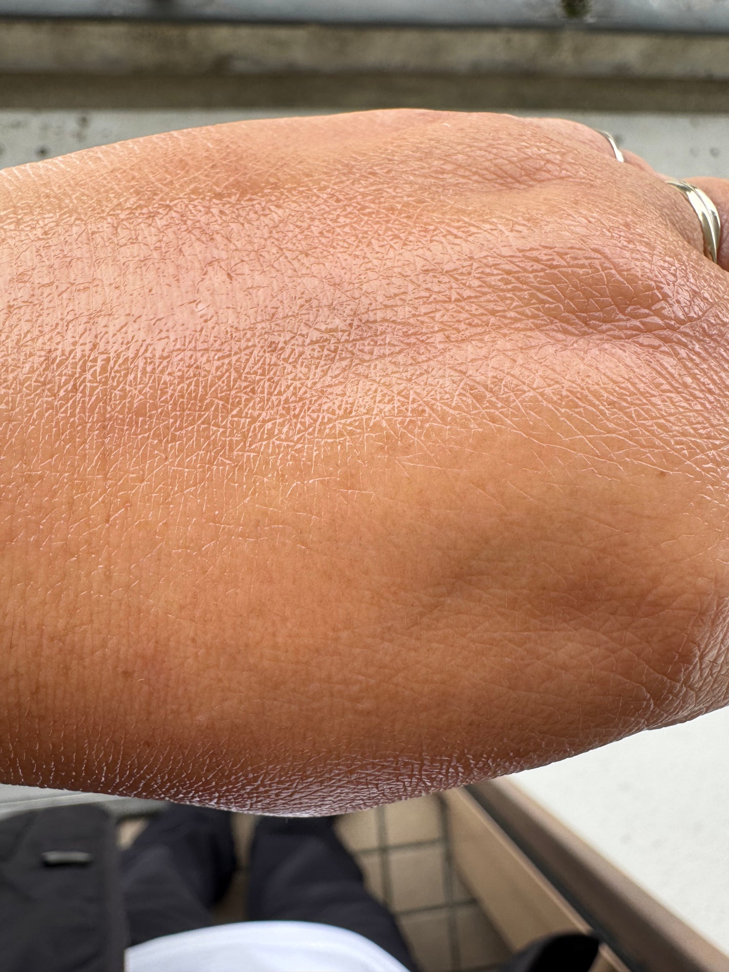 センテラ アンプル/SKIN1004/美容液を使ったクチコミ(2枚目)