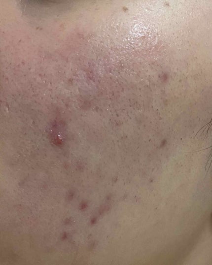 ハトムギ洗顔フォーム/株式会社イヴ/洗顔フォームを使ったクチコミ(3枚目)