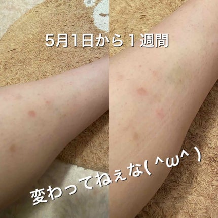 クナイプビオ オイル ローズ/クナイプ/ボディオイルを使ったクチコミ(3枚目)