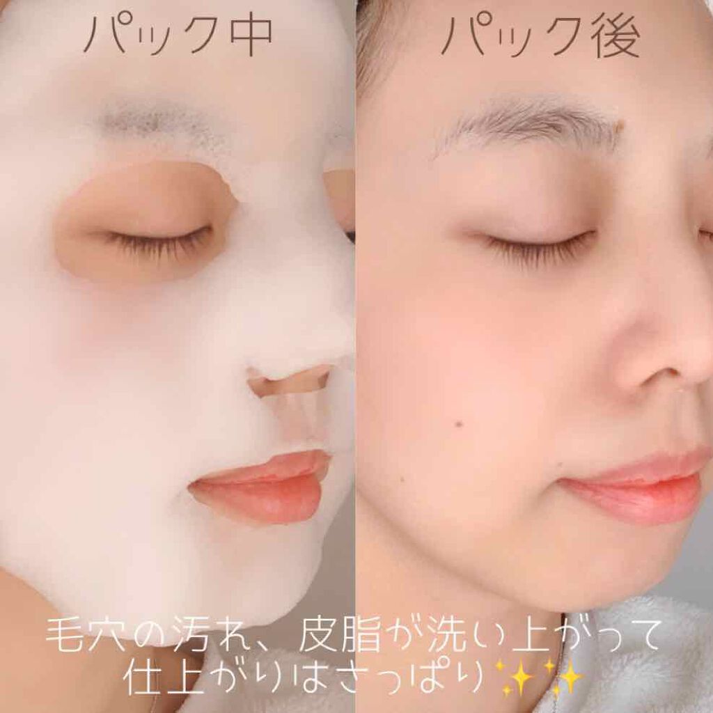 ホワイト もこもこ白泡マスク/リッツ/洗い流すパック・マスクを使ったクチコミ(2枚目)
