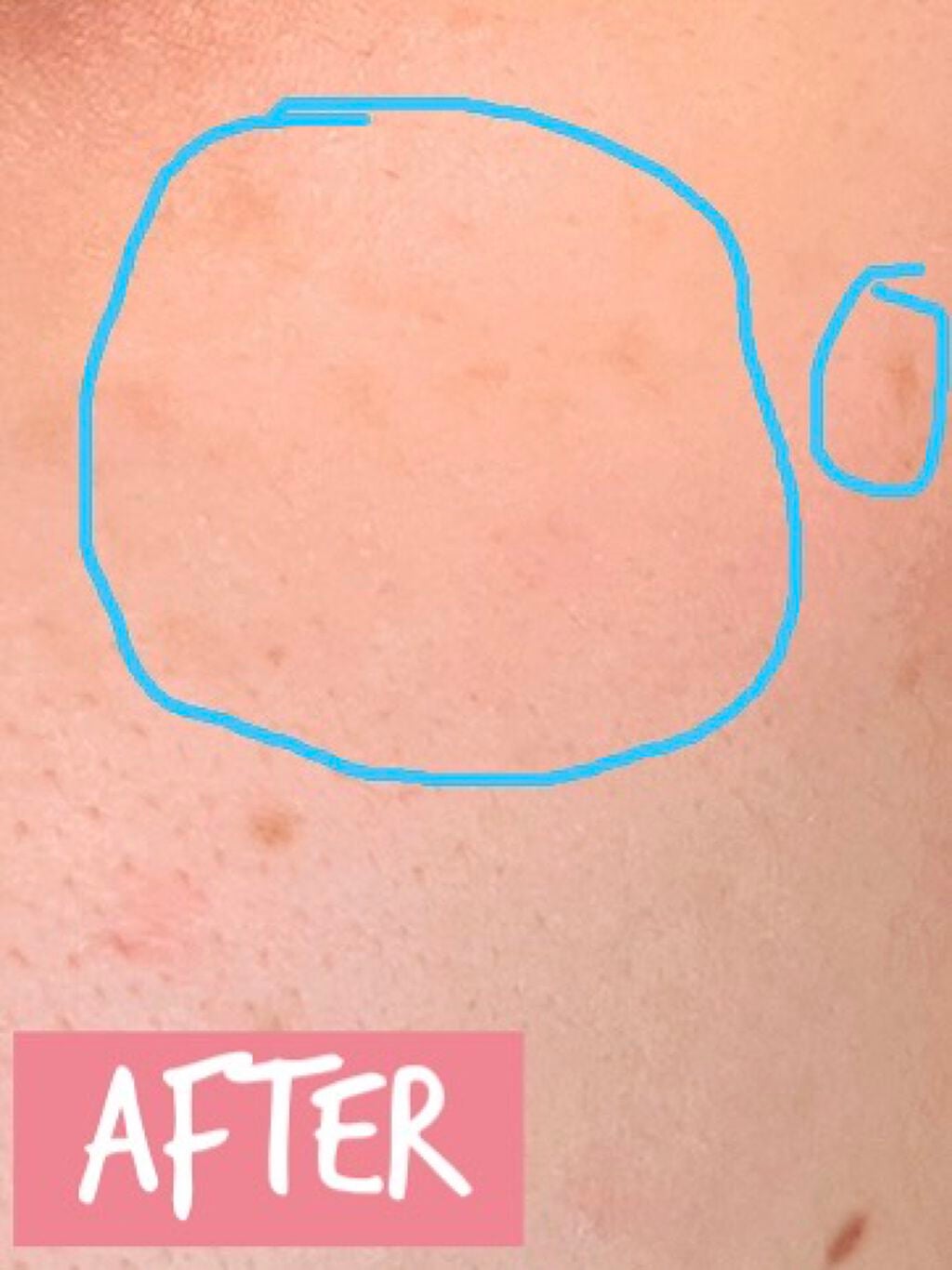 ビタミントーニングシミセラム/BIOHEAL BOH/美容液を使ったクチコミ(4枚目)