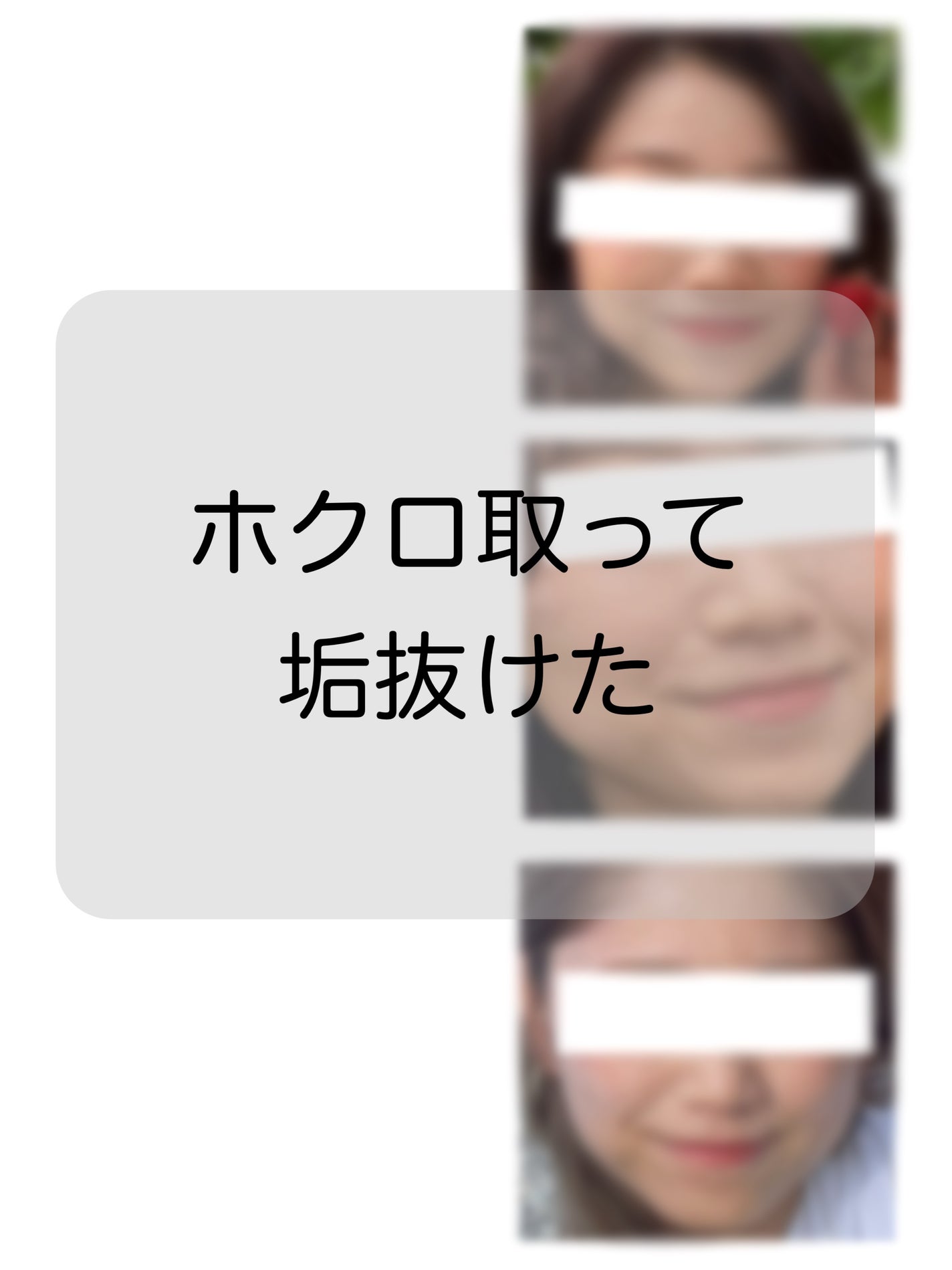 キズを早くきれいに治すパッチ|matsukiyoの口コミ - ホクロ取っ キズを早くきれいに治すパッチ|matsukiyoの口コミ - ホクロ取っ