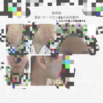 N10+Z1フェイスセラム /The Ordinary/美容液を使ったクチコミ(2枚目)