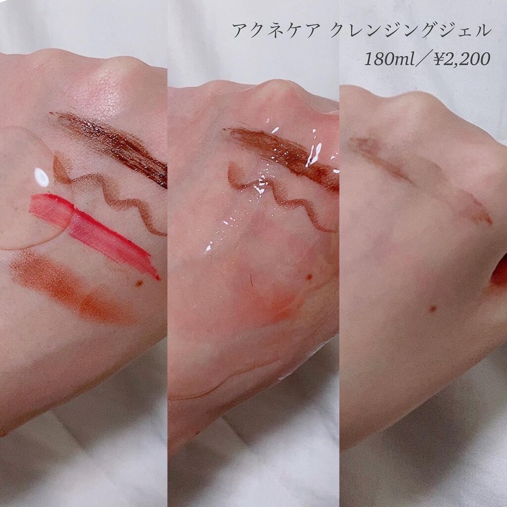 アロフローラ アクネケア クレンジングジェル/ハウス オブ ローゼ/クレンジングジェルを使ったクチコミ(2枚目)