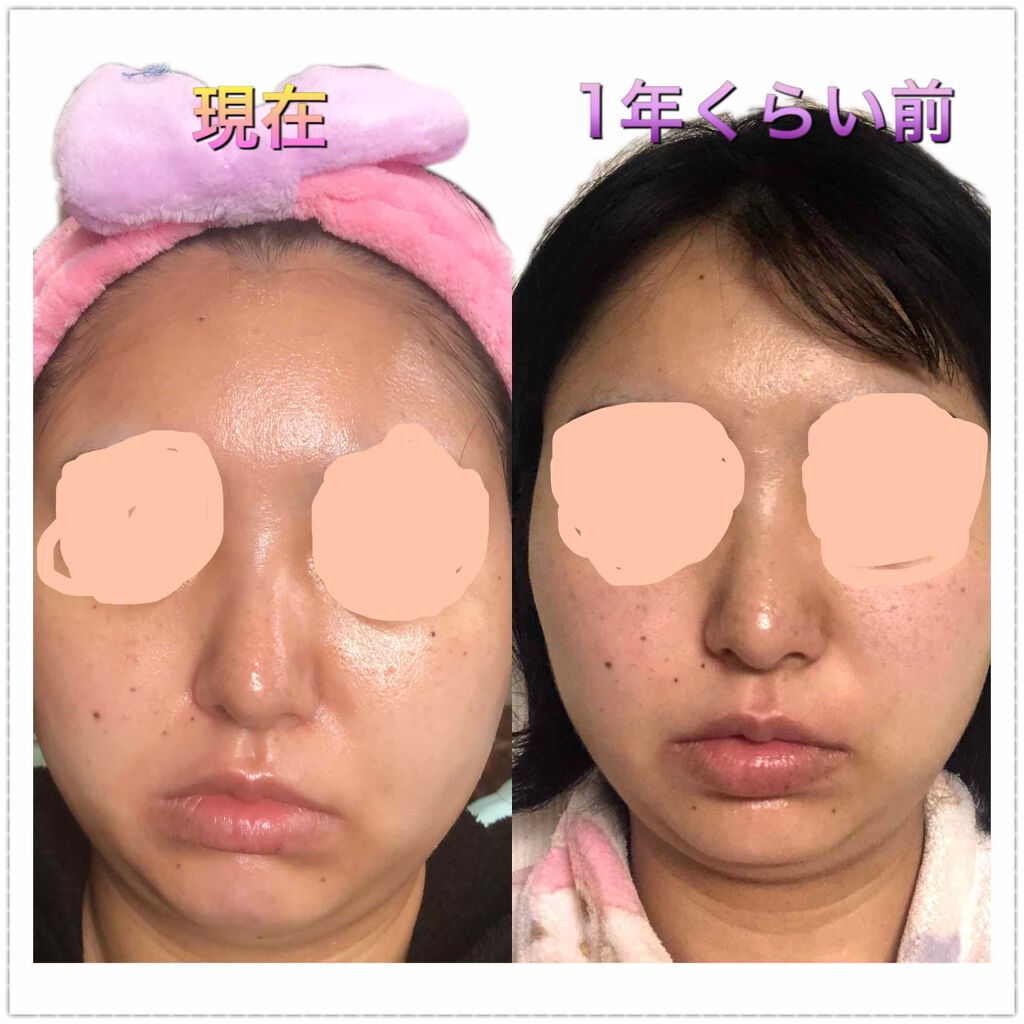 薬用 しみ 集中対策 美容液/メラノCC/美容液を使ったクチコミ(3枚目)