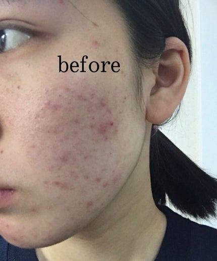 赤箱 (しっとり)/カウブランド/洗顔石鹸を使ったクチコミ(2枚目)