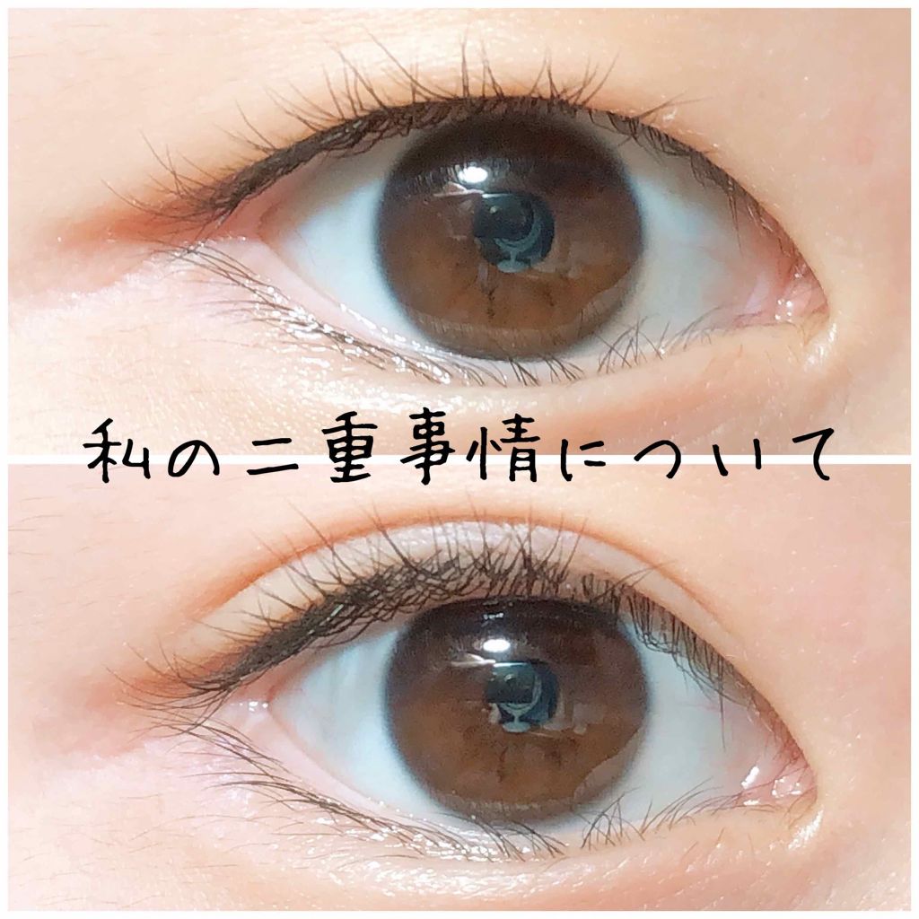 アイトーク/アイトーク/二重まぶた用アイテムを使ったクチコミ（1枚目）