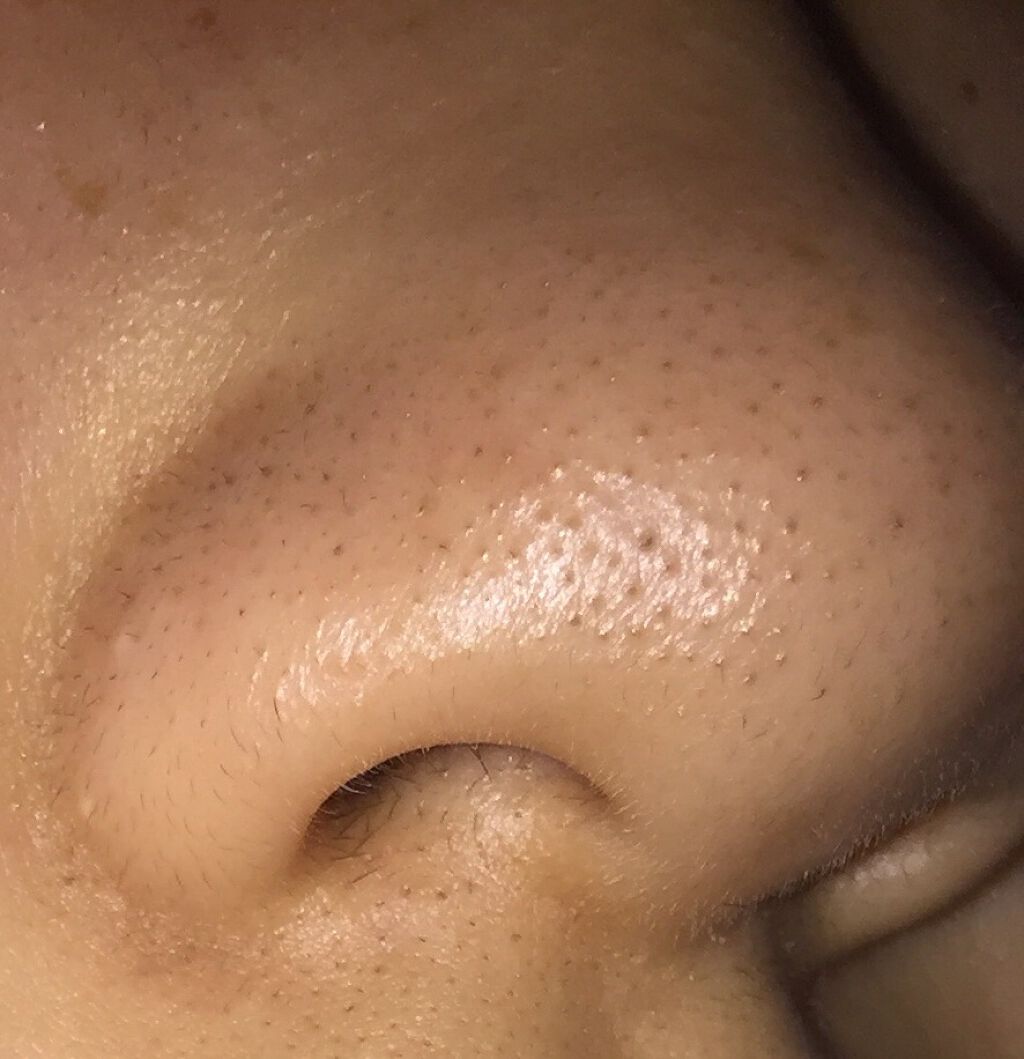 ななみん!! on LIPS 「これはiPhoneのノーマルカメラで撮りました!好きな人後でき..」(4枚目)