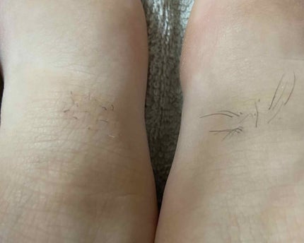 ブラウンシルクエキスパート (光美容器)/ブラウン/家庭用脱毛器を使ったクチコミ(2枚目)