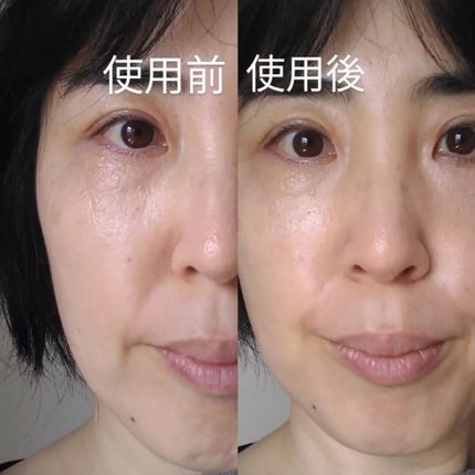 デイリートナーパッド/NEEDLY/トナーパッドを使ったクチコミ(2枚目)