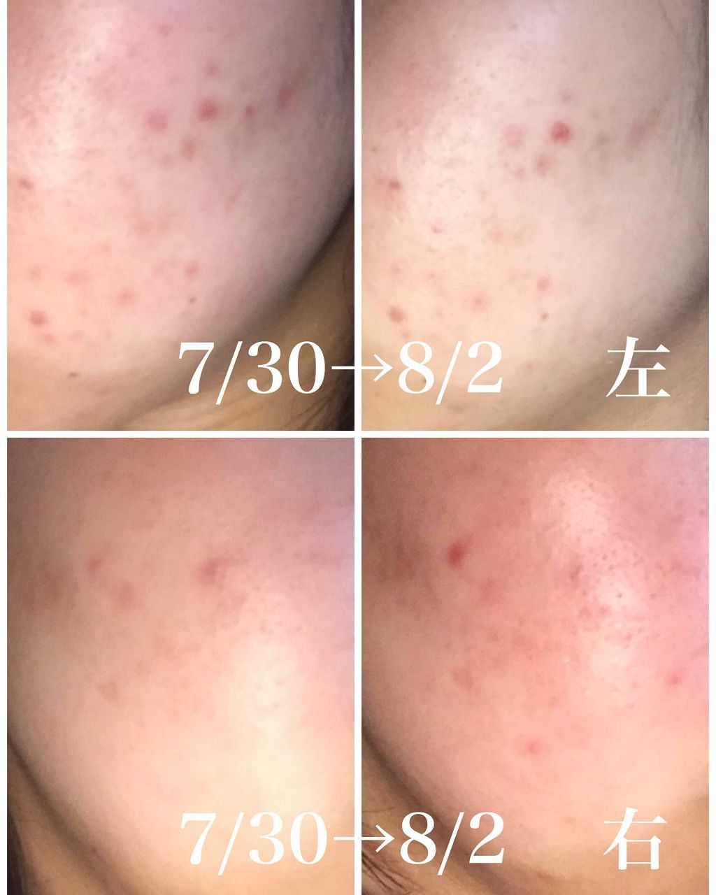 ハトムギ化粧水(ナチュリエ スキンコンディショナー R )/ナチュリエ/化粧水を使ったクチコミ（3枚目）