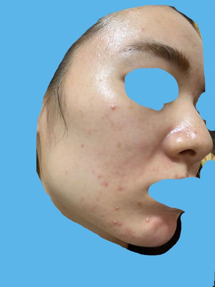 潤浸保湿 化粧水 III とてもしっとり/キュレル/化粧水を使ったクチコミ(3枚目)