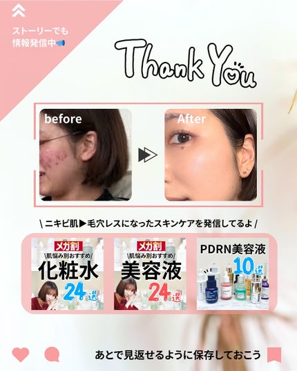 リードルショット300/VT/美容液を使ったクチコミ(9枚目)