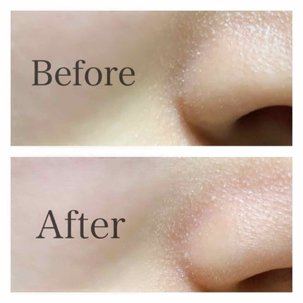 プレミアム ホットジェルクレンジング/ラチェスカ/クレンジングジェルを使ったクチコミ(4枚目)