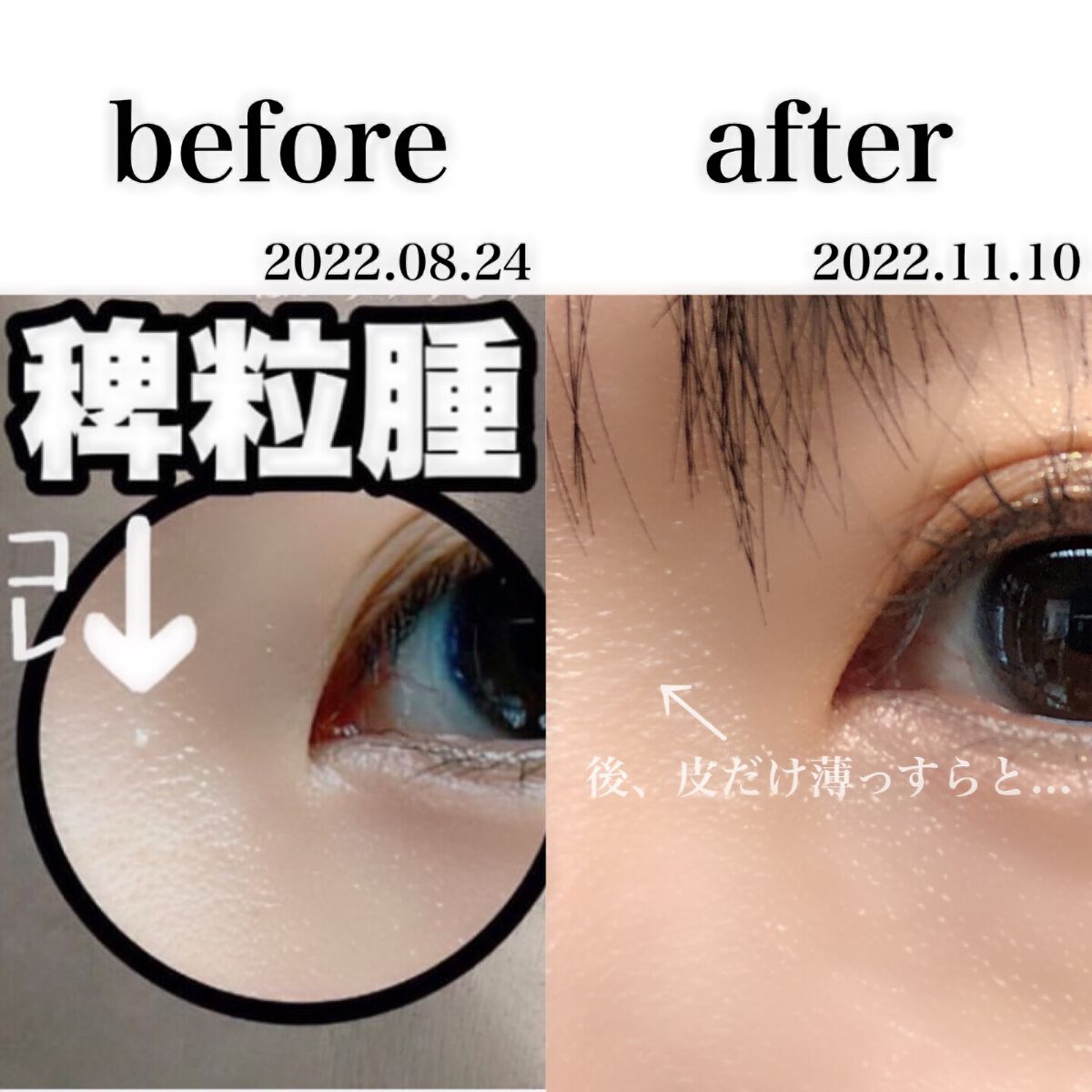 オーガニック ハトムギエキス (ヨクイニン)/KISO/その他を使ったクチコミ（2枚目）