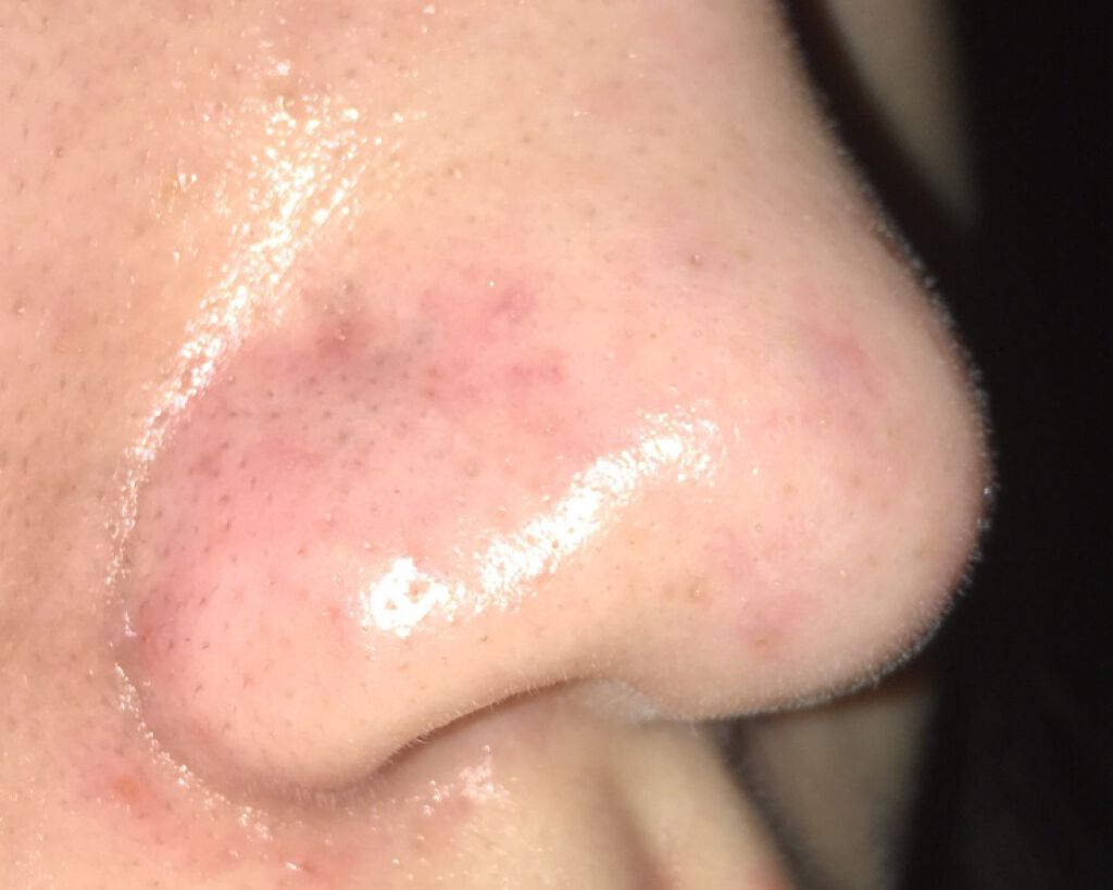 ホホバオイル 100ml/無印良品/ボディオイルを使ったクチコミ（3枚目）