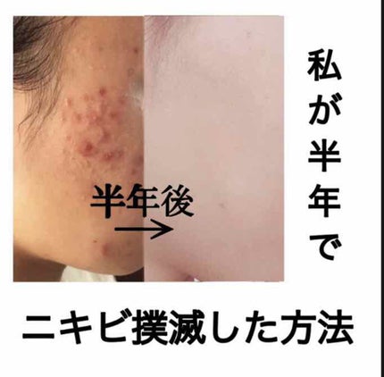 コラージュ 洗顔パウダー/コラージュ/洗顔パウダーを使ったクチコミ(1枚目)