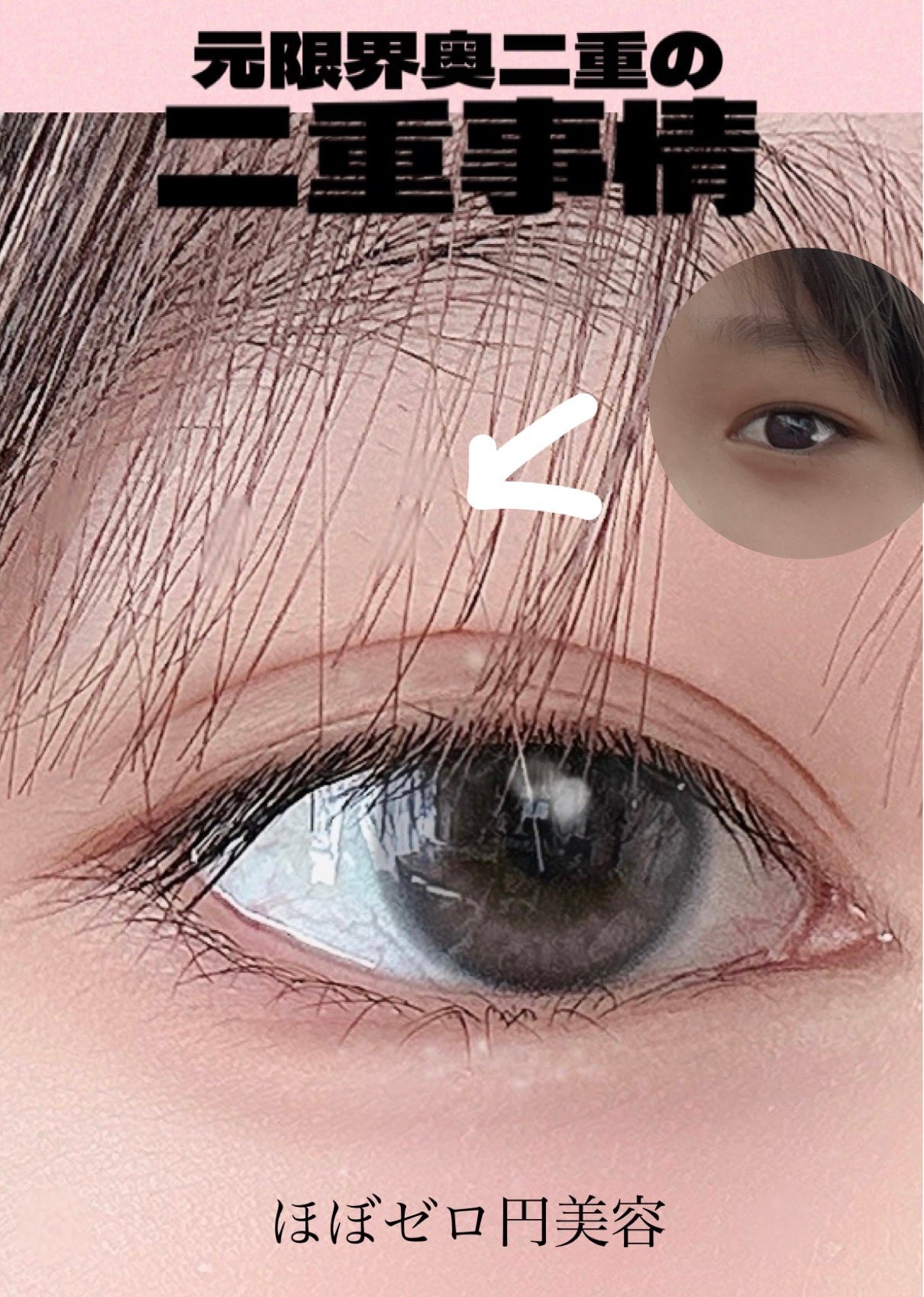 のびーるアイテープ(絆創膏タイプ、レギュラー)/DAISO/二重まぶた用アイテムを使ったクチコミ(1枚目)