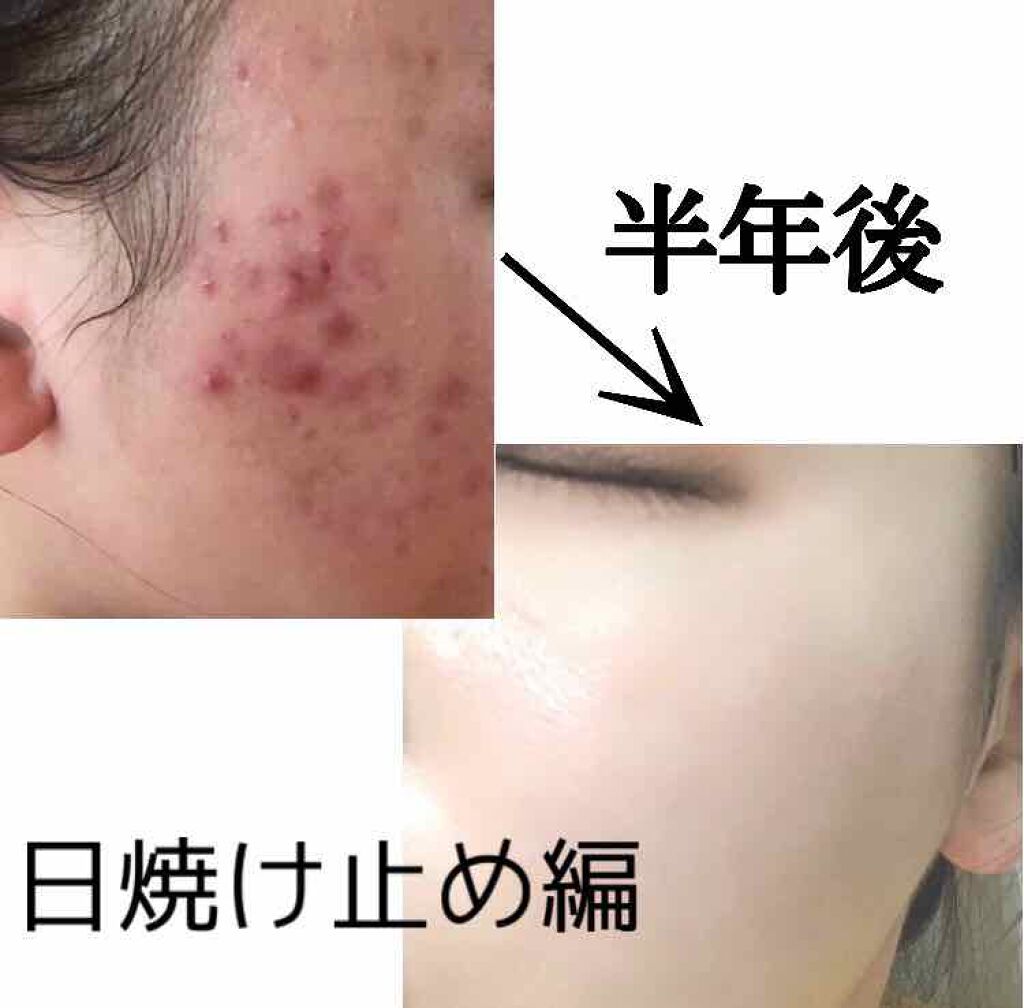 UVエッセンス SPF30/キュレル/日焼け止め・UVケアを使ったクチコミ(1枚目)