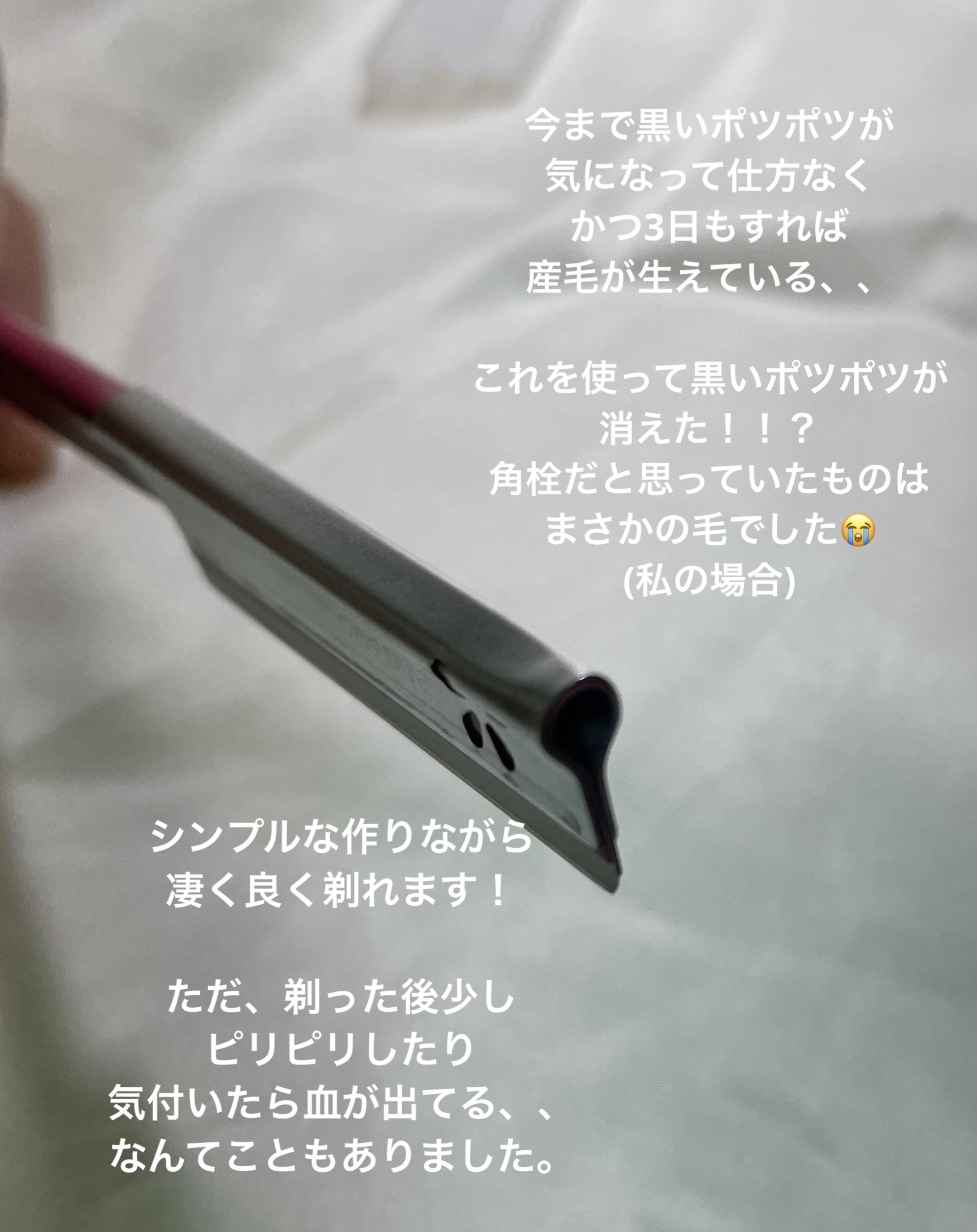 長柄カミソリ ビューティーM /貝印/シェーバーを使ったクチコミ（3枚目）