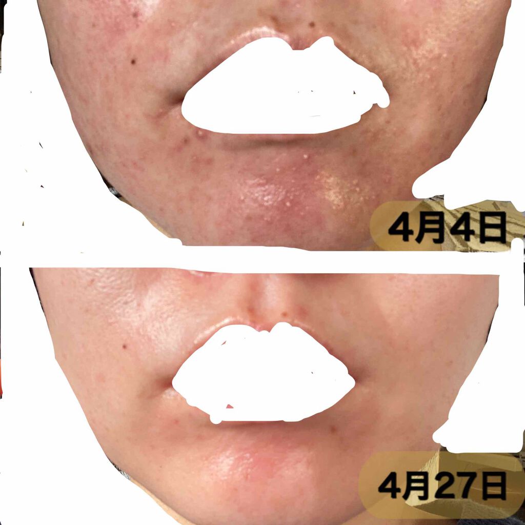 amin on LIPS 「こんばんは!自宅待機が長引きそうですが皆さんここでは自分磨きの..」(3枚目)