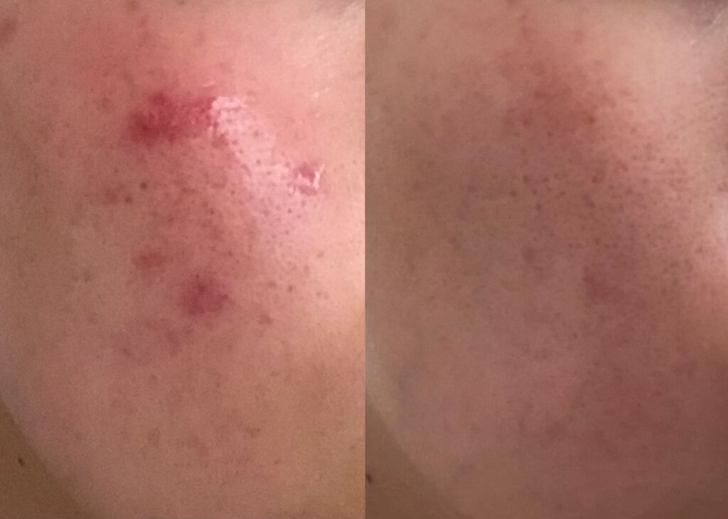 明色美顔水 薬用化粧水/美顔/化粧水を使ったクチコミ（1枚目）