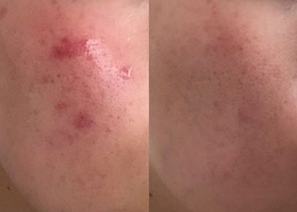 明色美顔水 薬用化粧水/美顔/化粧水を使ったクチコミ(1枚目)