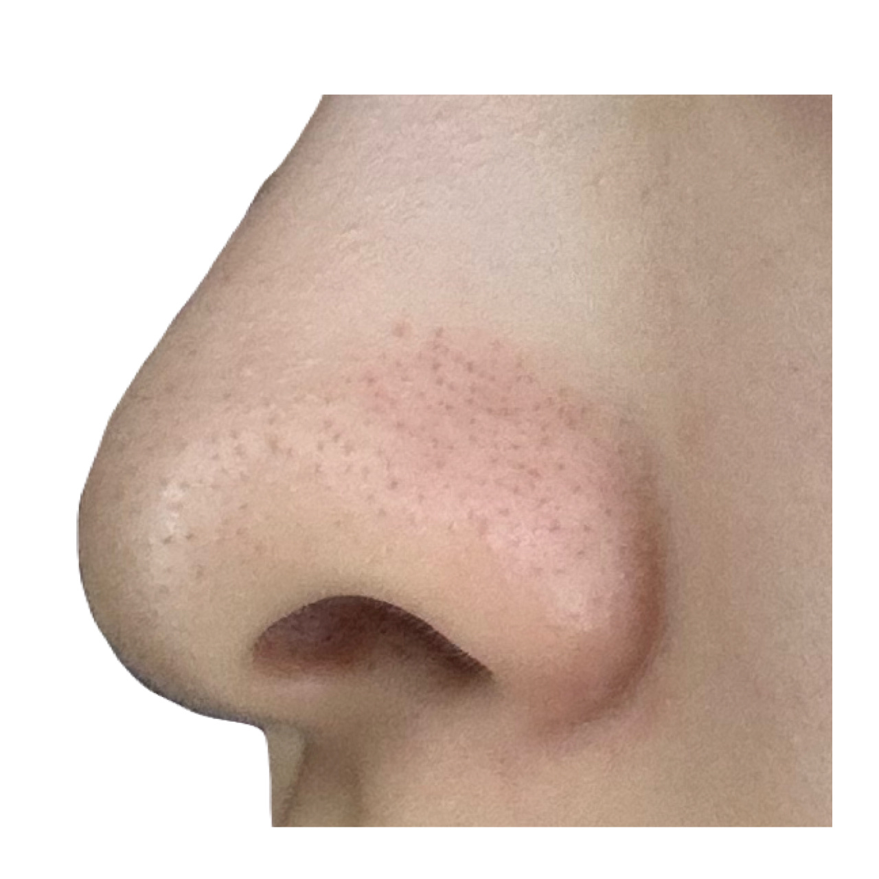 ノーモアブラックヘッド(ノーズピーリング)/One-day's you/スクラブ・ゴマージュを使ったクチコミ（3枚目）