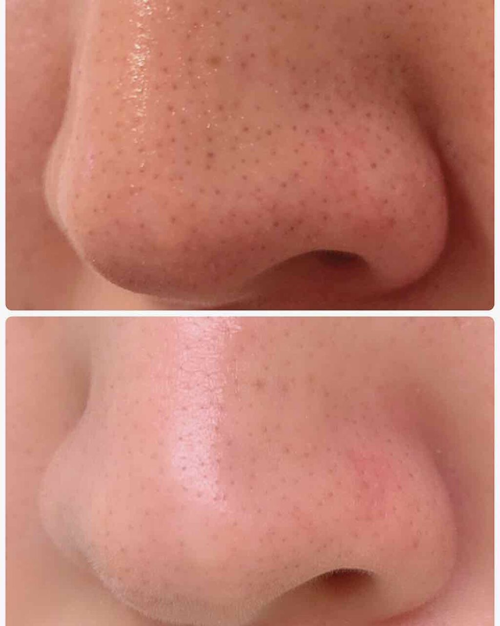 カネボウ ソフニング クリーム クレンジング/KANEBO/クレンジングクリームを使ったクチコミ（2枚目）